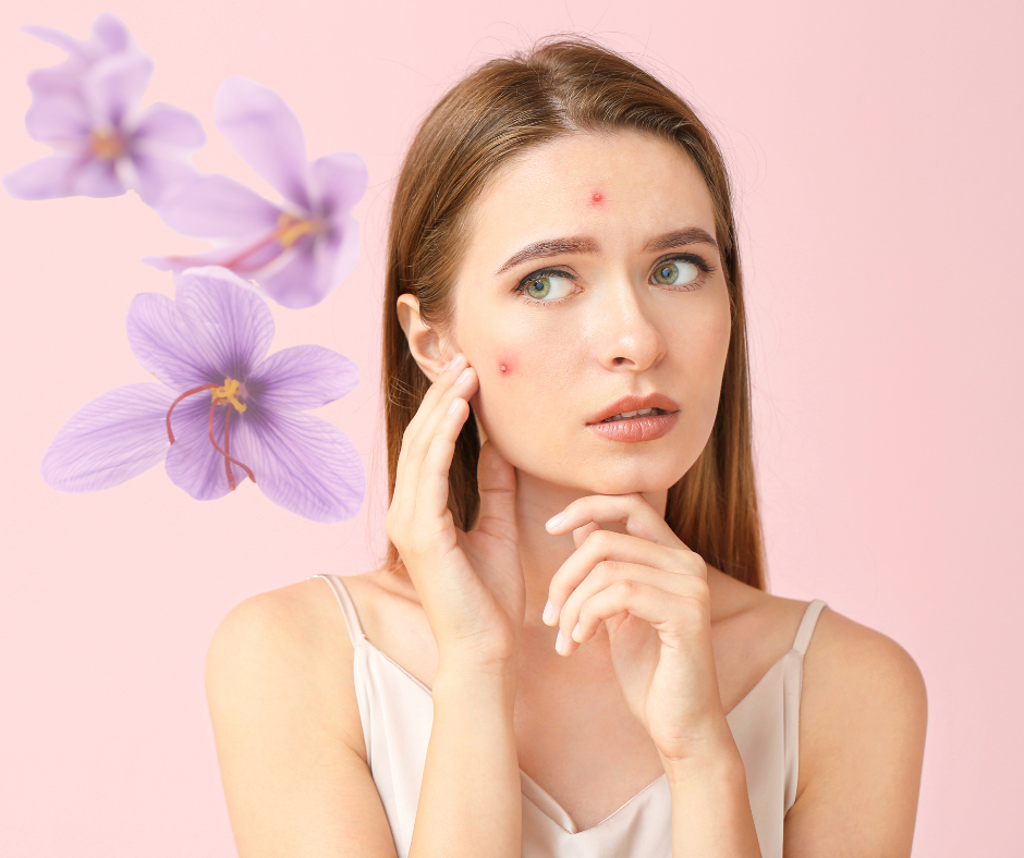  Clearer Skin Starts Here: The Hidden Power of Kashmiri Saffron for Acne 